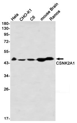 CSNK2A1 Rabbit Monoclonal Antibody
