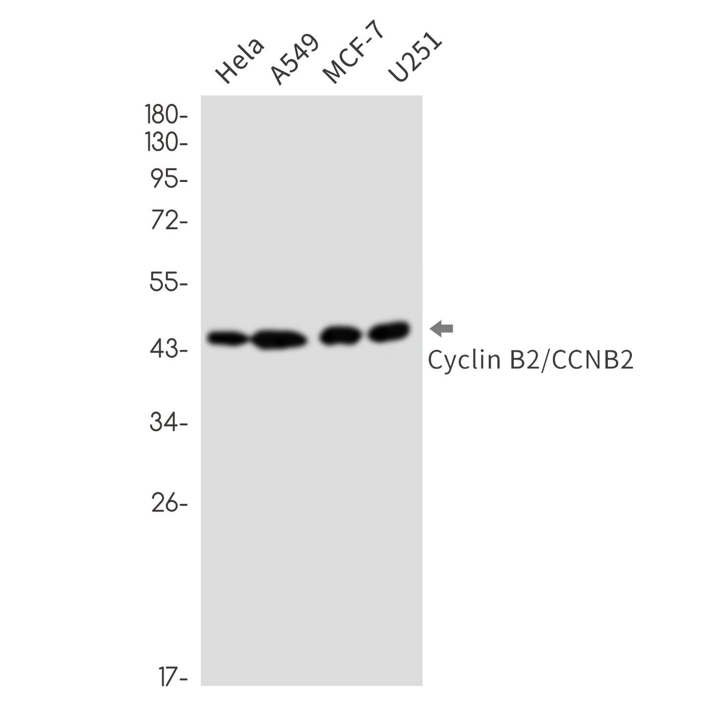 Cyclin B2 Rabbit Monoclonal Antibody