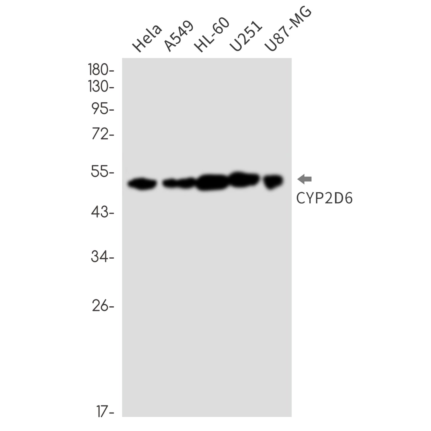 Cytochrome P450 2D6 Rabbit Monoclonal Antibody