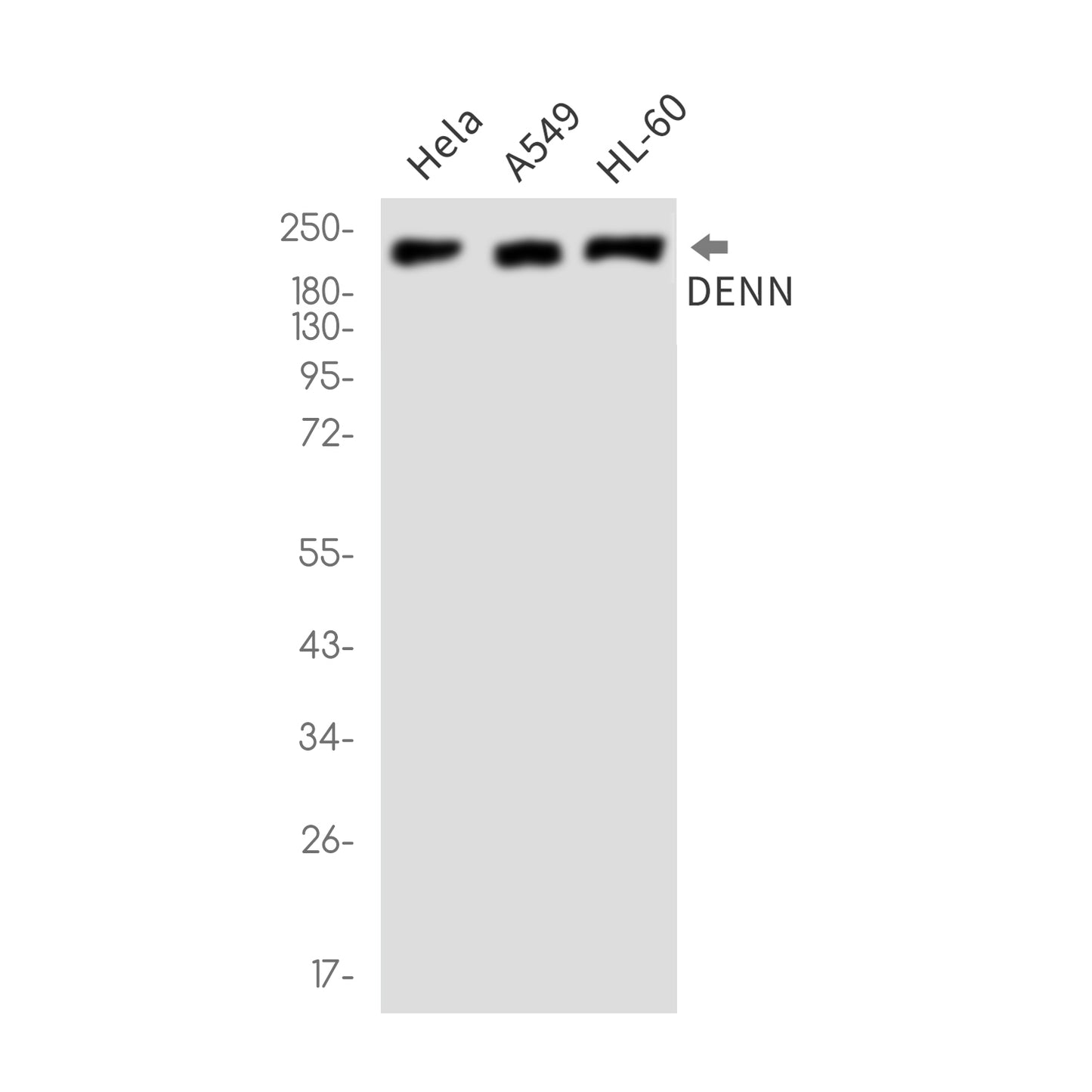 DENN Rabbit Monoclonal Antibody