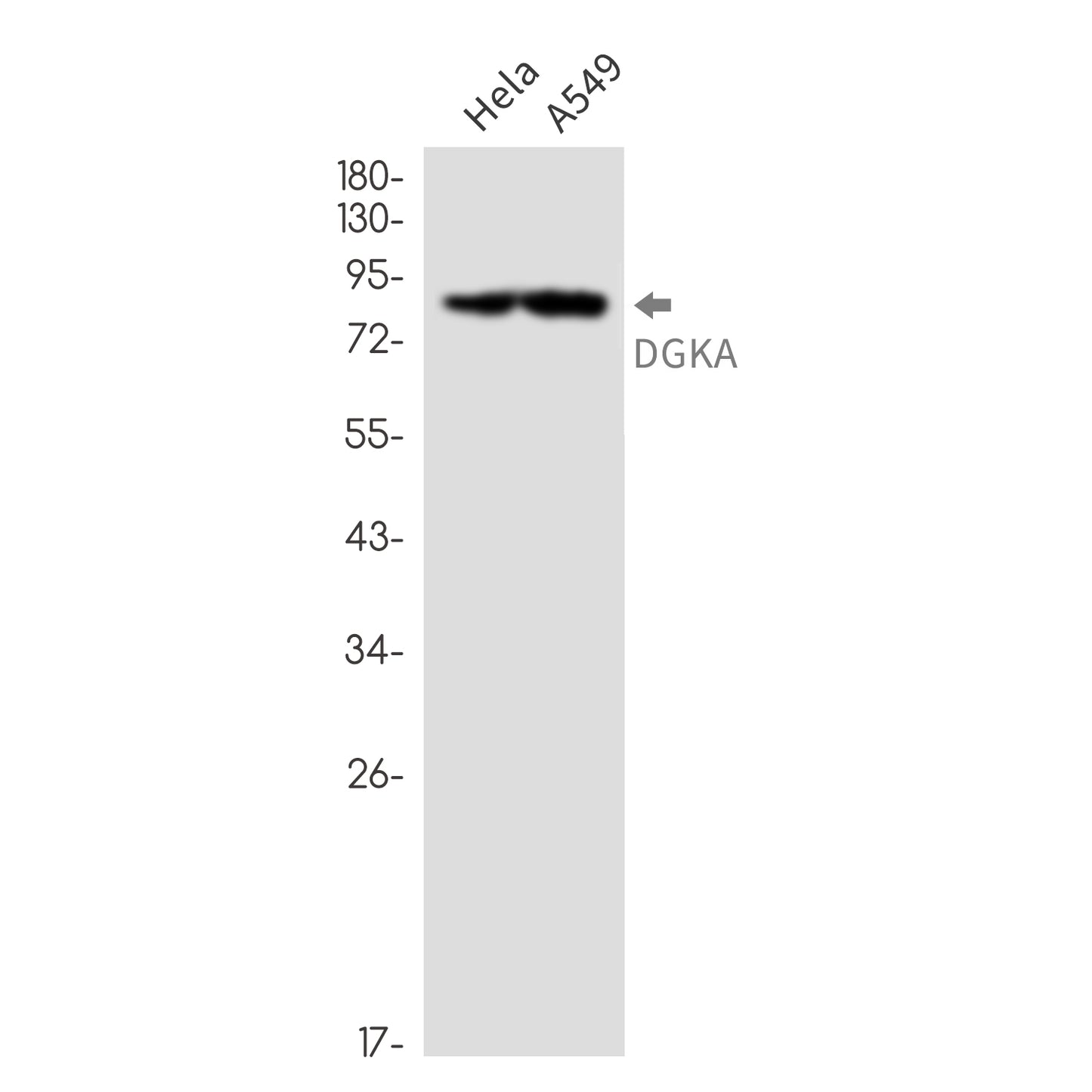DGKA Rabbit Monoclonal Antibody