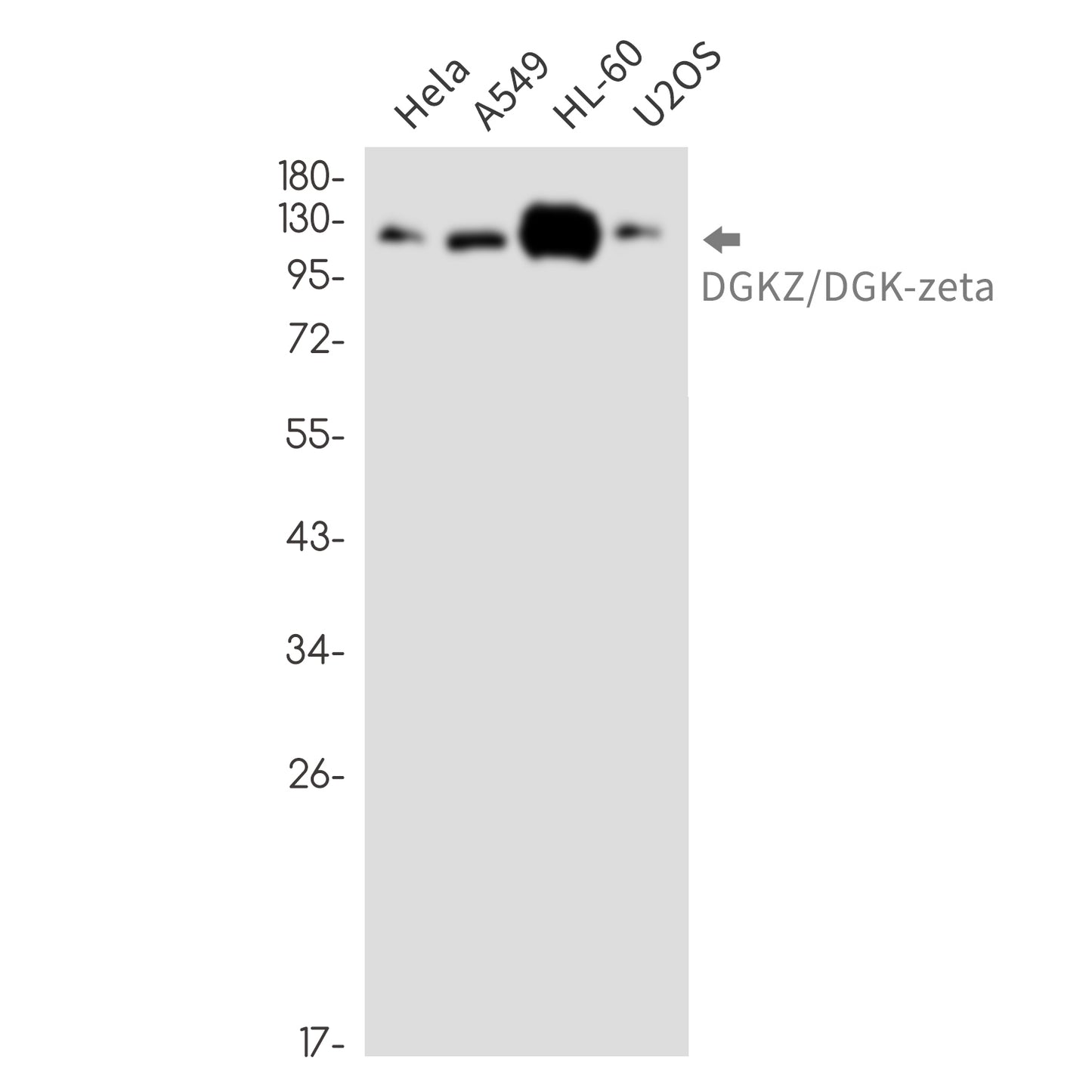 DGKZ Rabbit Monoclonal Antibody