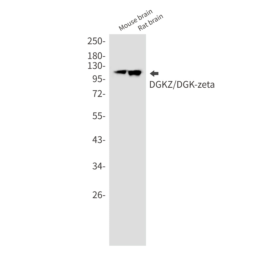 DGKZ Rabbit Monoclonal Antibody