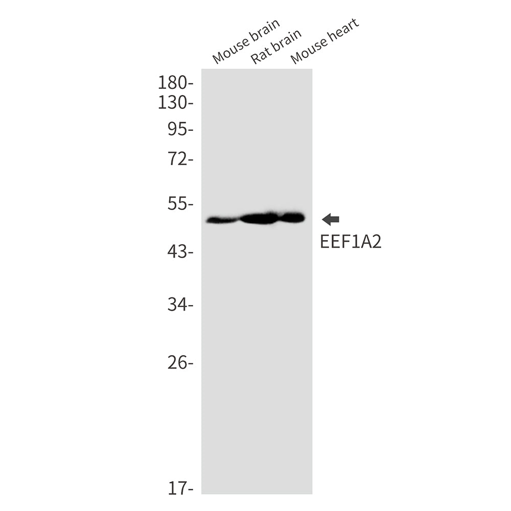 Elongation Factor 1A2 Rabbit Monoclonal Antibody