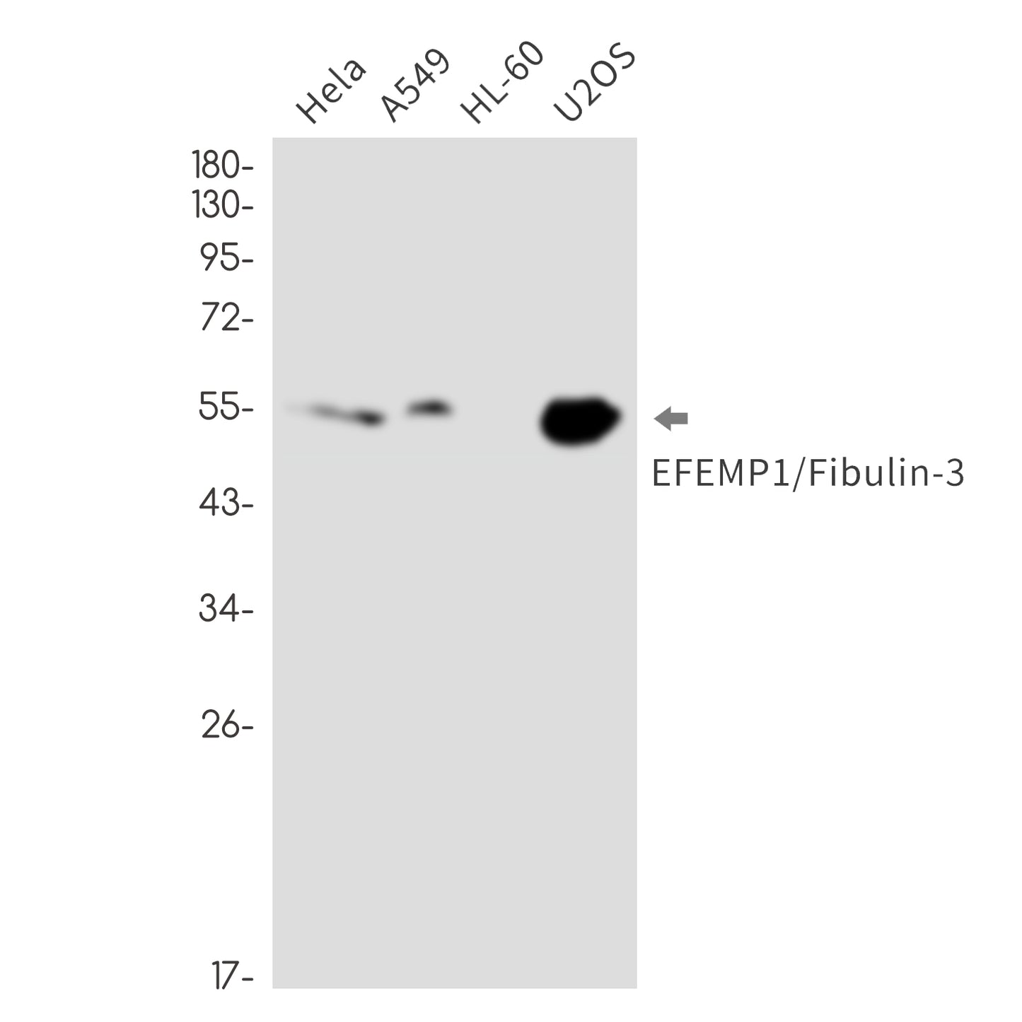EFEMP1 Rabbit Monoclonal Antibody
