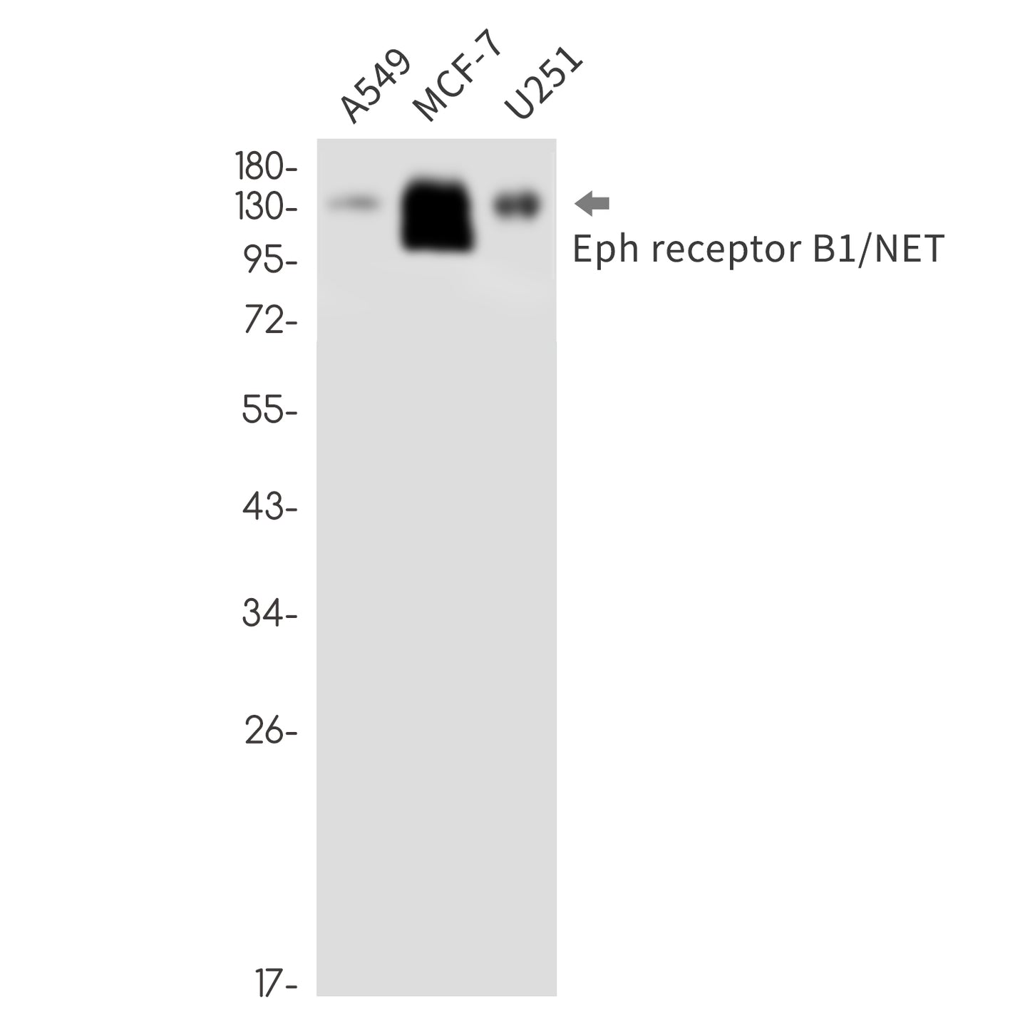 Ephrin Receptor B1 Rabbit Monoclonal Antibody