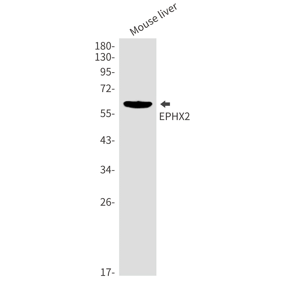 Epoxide Hydrolase 1 Rabbit Monoclonal Antibody