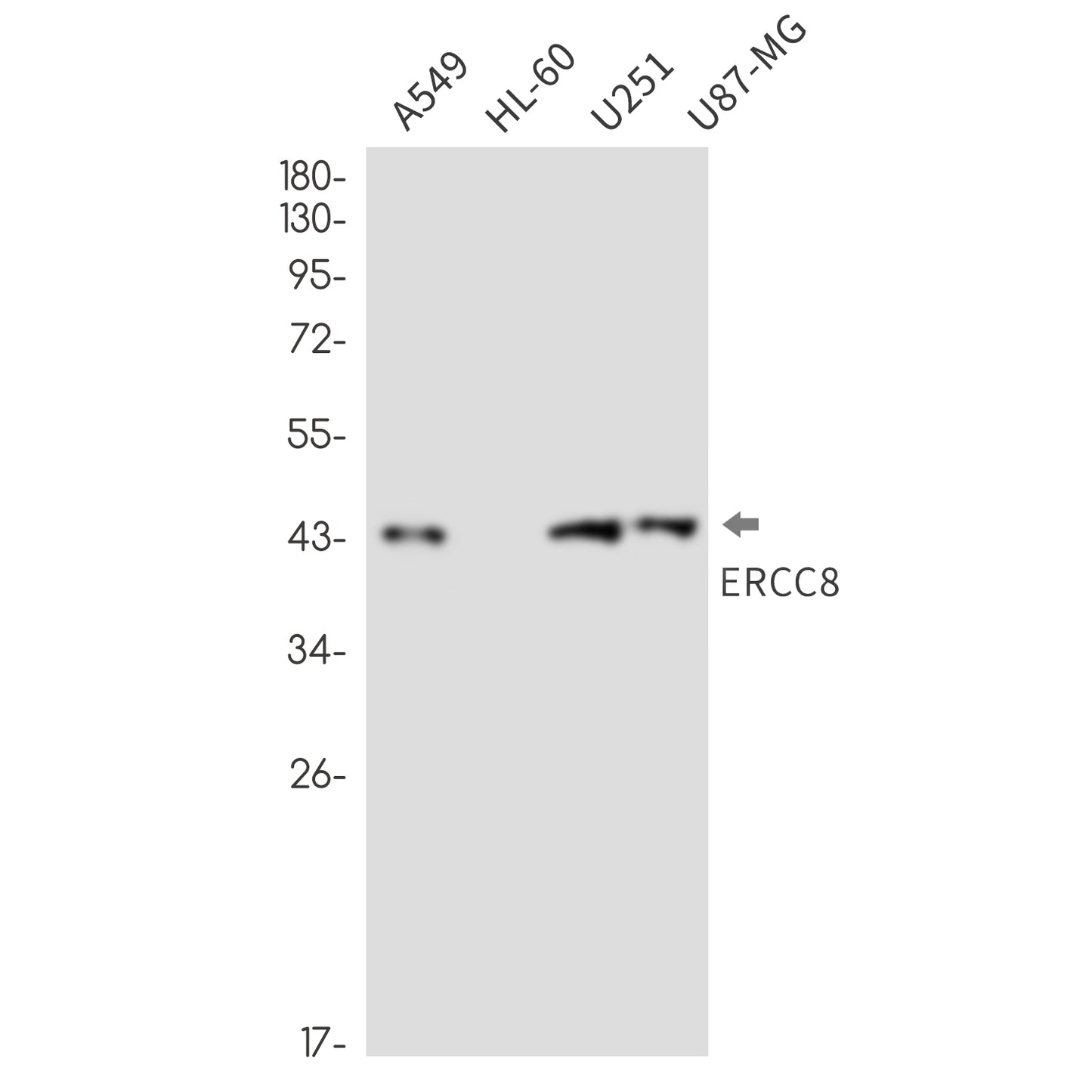 ERCC8 Rabbit Monoclonal Antibody
