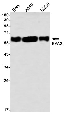 EYA2 Rabbit Monoclonal Antibody