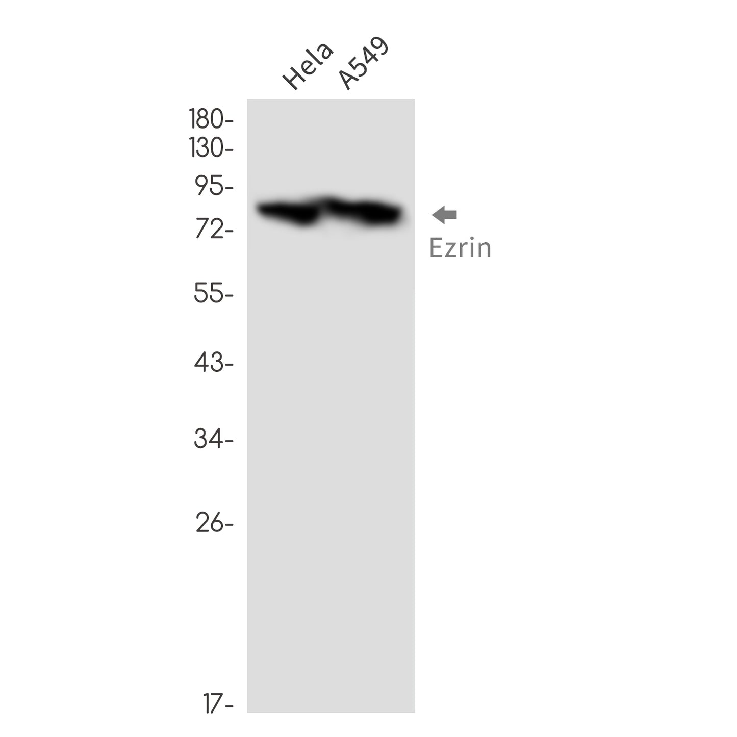 Ezrin Rabbit Monoclonal Antibody