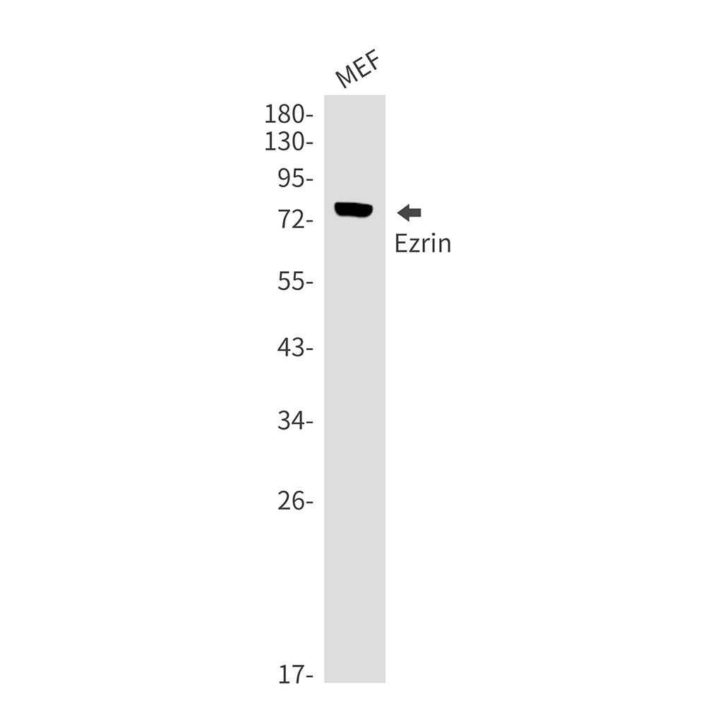 Ezrin Rabbit Monoclonal Antibody