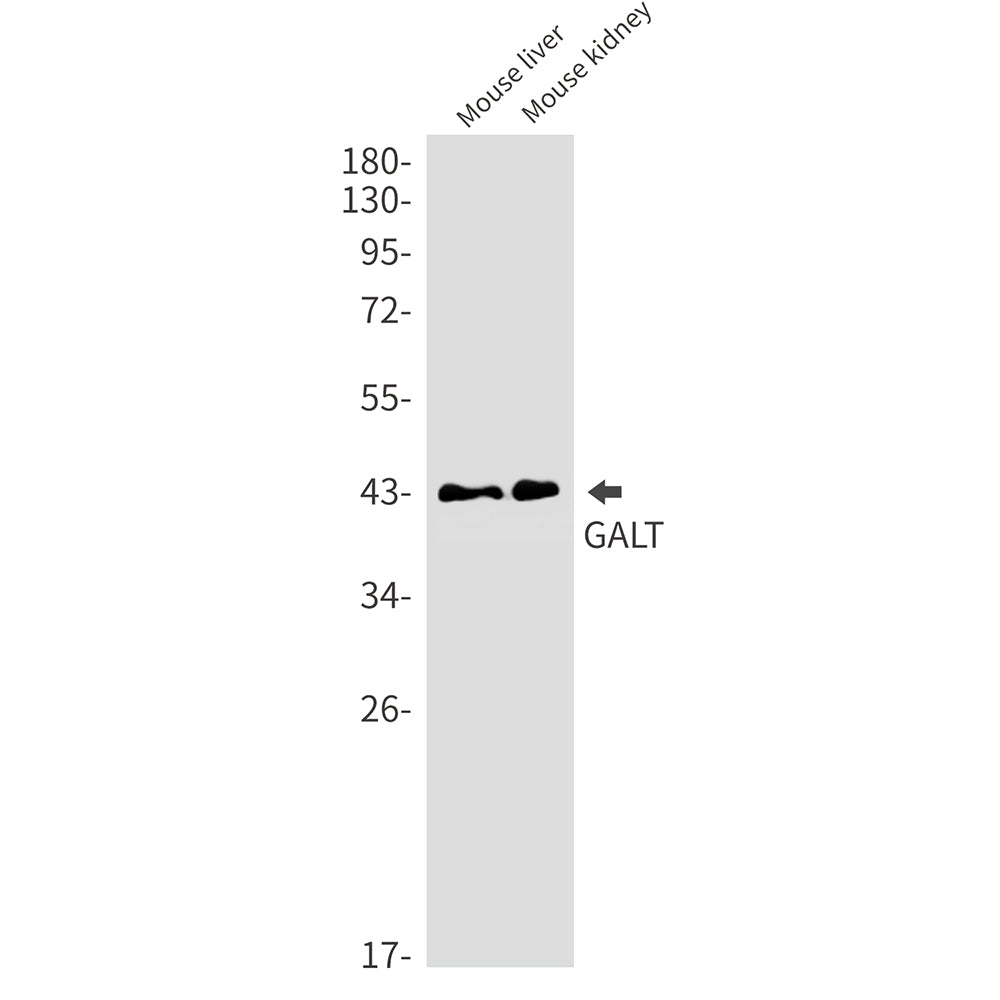 GALT Rabbit Monoclonal Antibody
