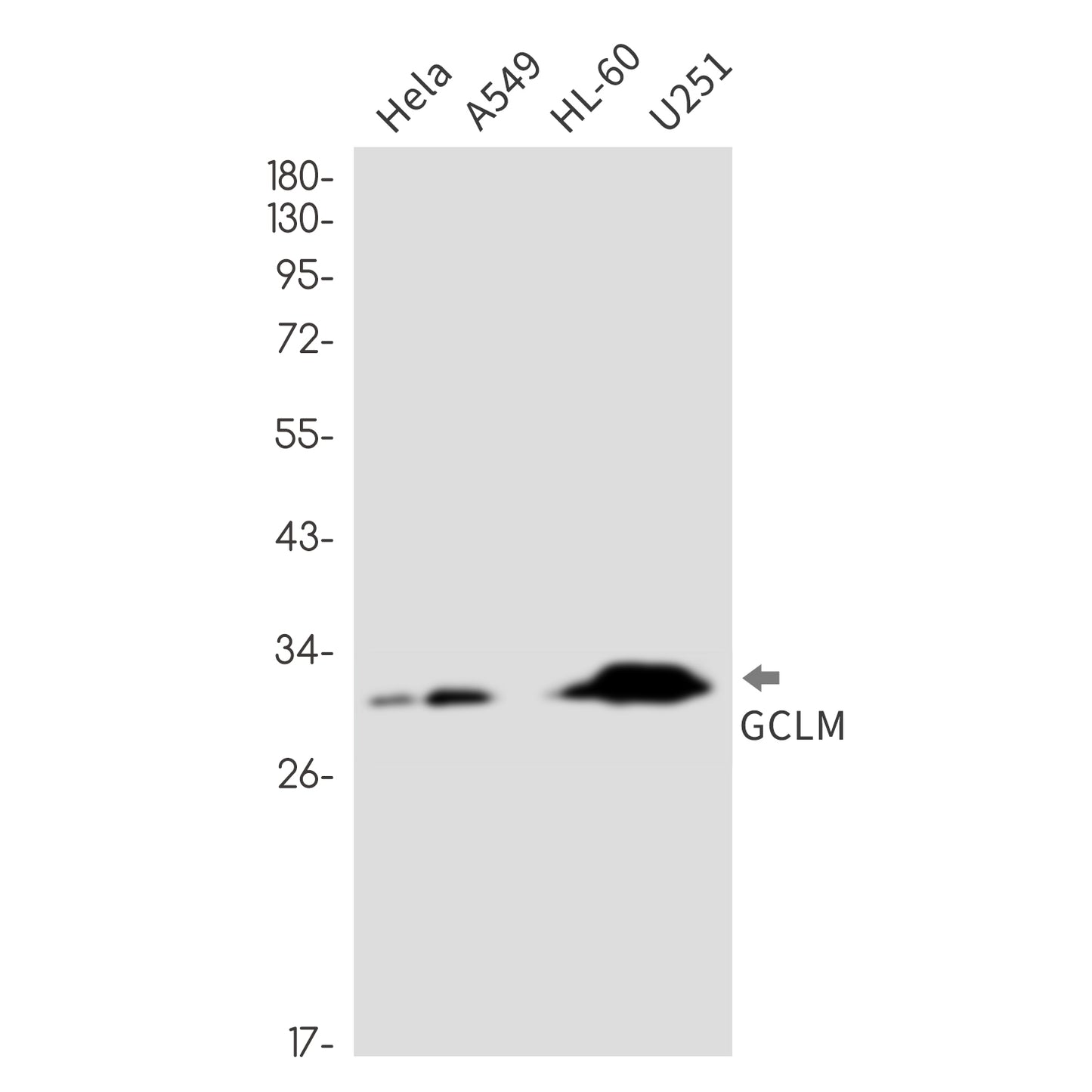 GCLM Rabbit Monoclonal Antibody