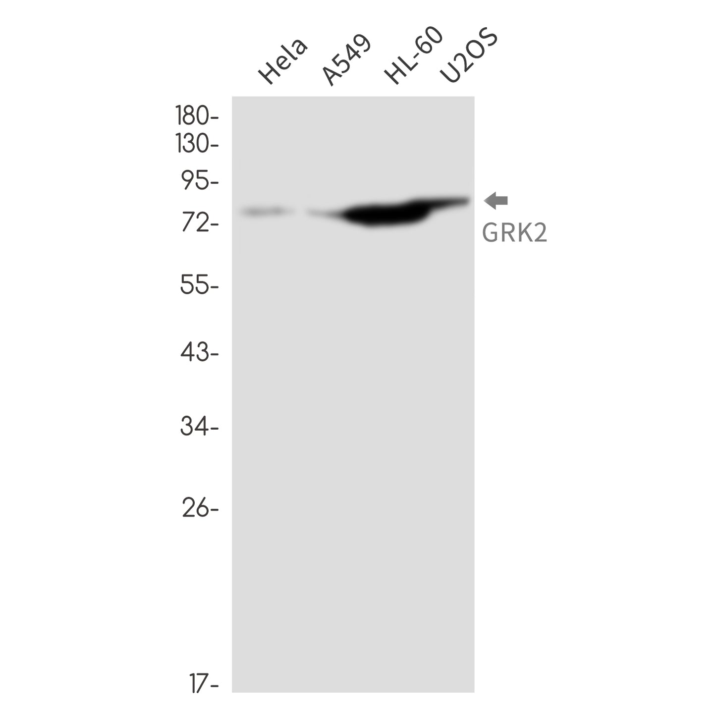 GRK2 Rabbit Monoclonal Antibody