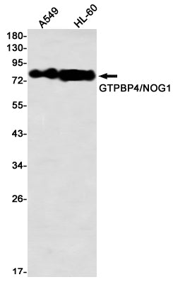 GTPBP4 Rabbit Monoclonal Antibody