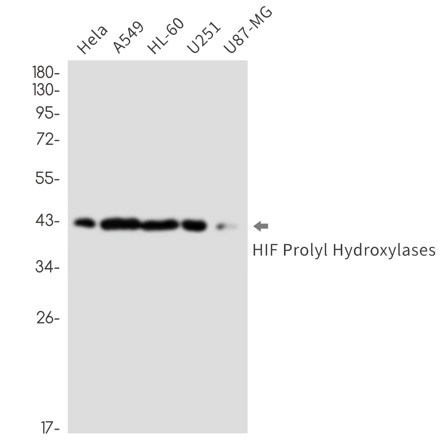 HIF Prolyl Hydroxylases Rabbit Monoclonal Antibody