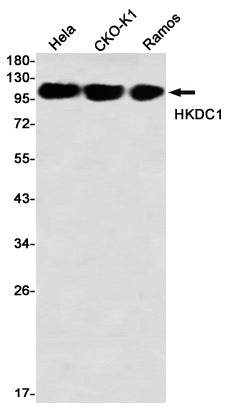 HKDC1 Rabbit Monoclonal Antibody
