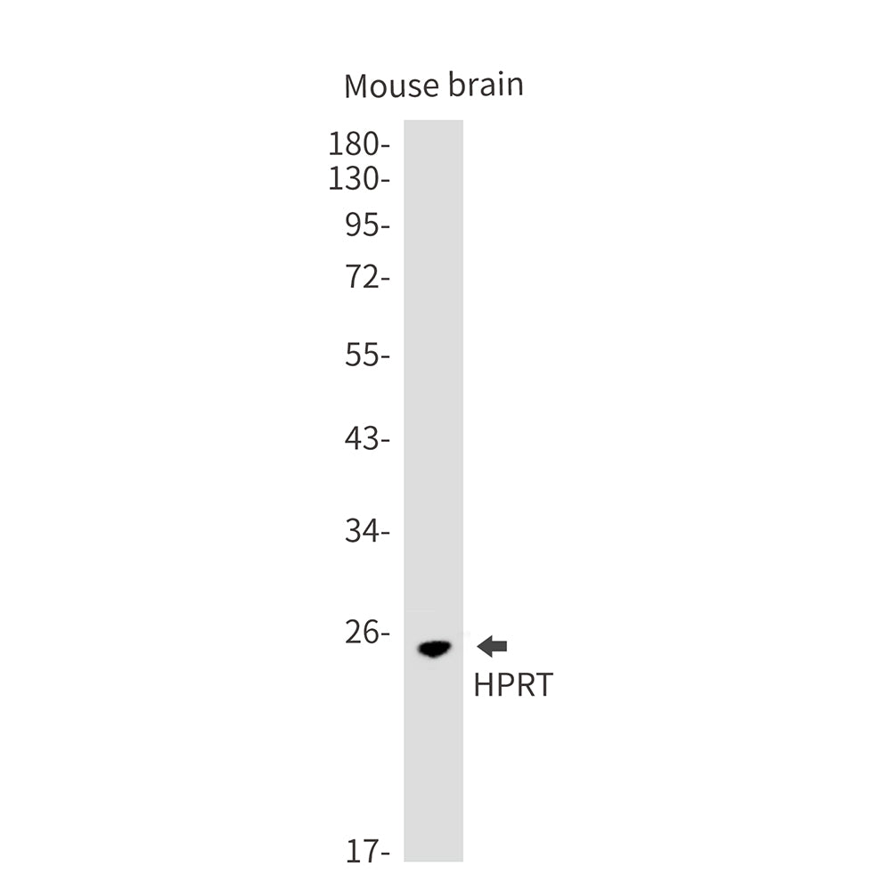 HPRT Rabbit Monoclonal Antibody