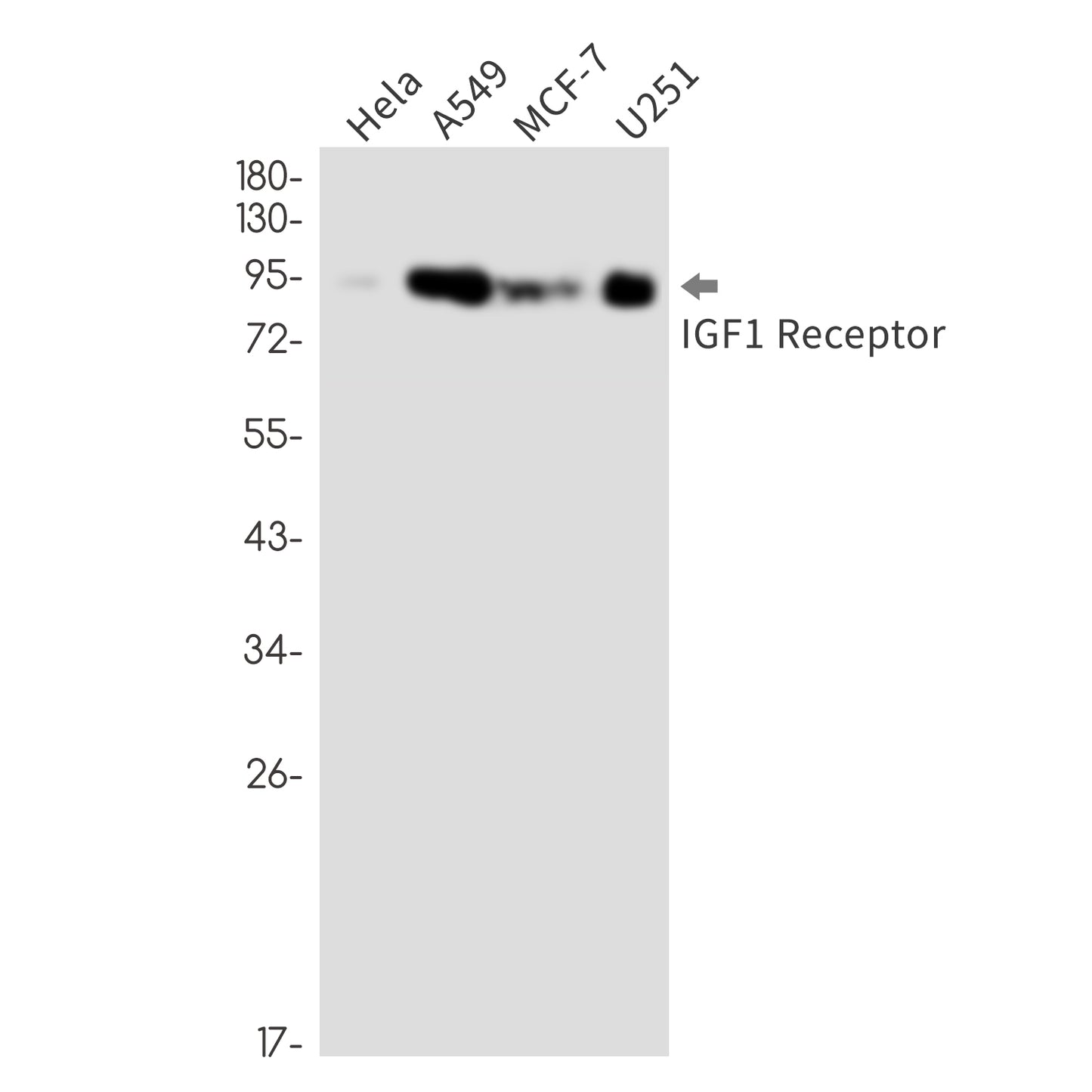 IGF1 Receptor Rabbit Monoclonal Antibody