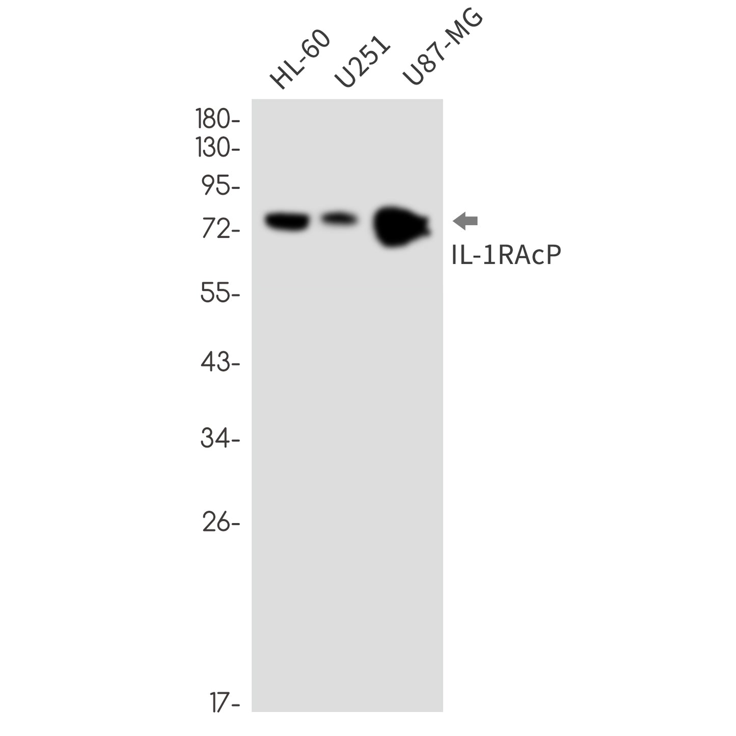 IL-1 Receptor Accessory Protein Rabbit Monoclonal Antibody