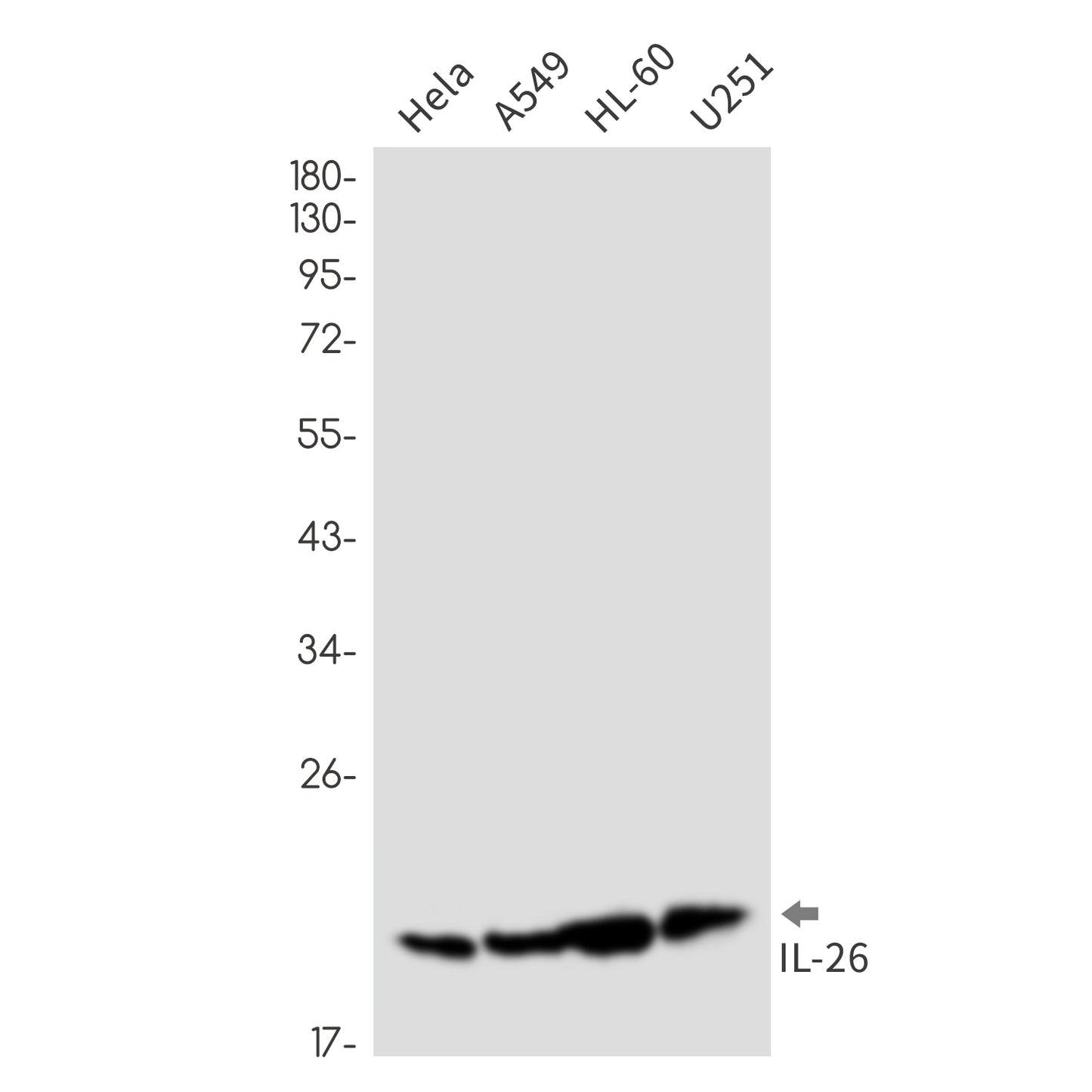 IL-26 Rabbit Monoclonal Antibody