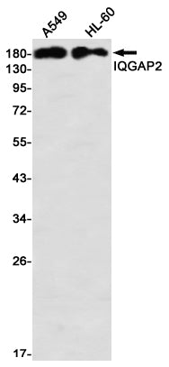 IQGAP2 Rabbit Monoclonal Antibody
