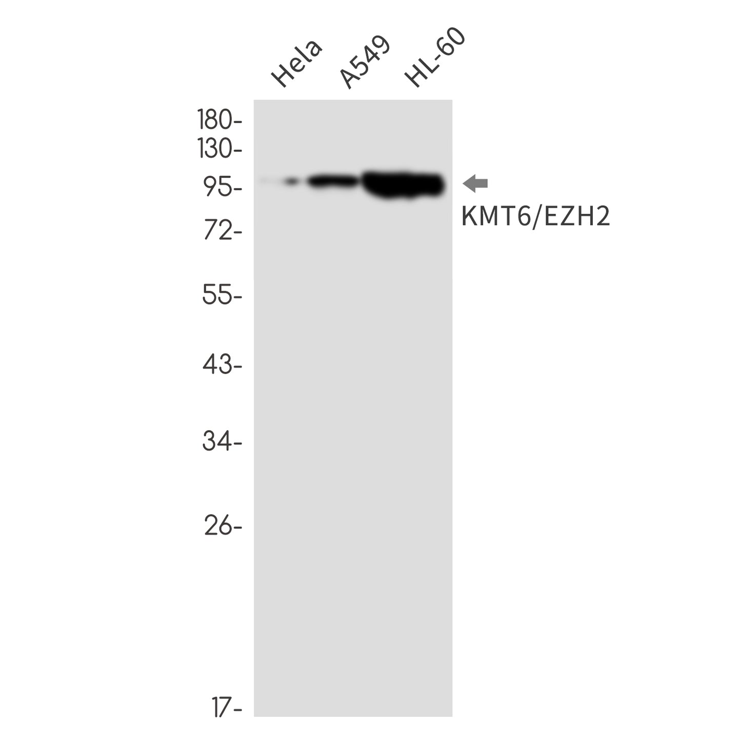 KMT6 Rabbit Monoclonal Antibody