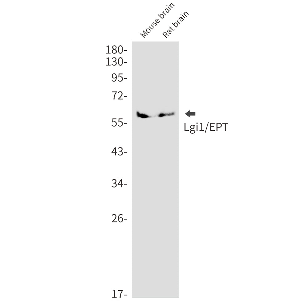 LGI1 Rabbit Monoclonal Antibody