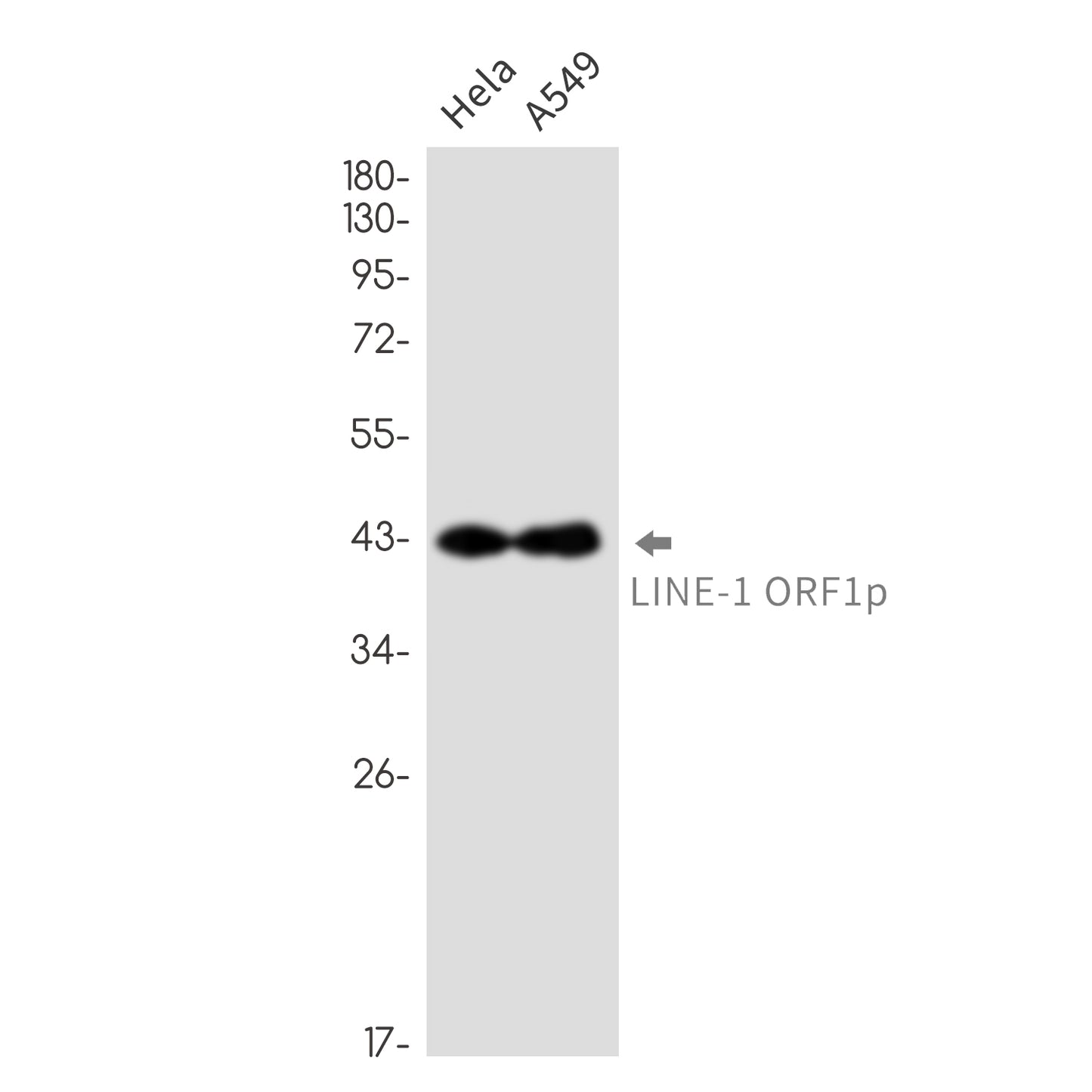 LINE 1 ORF1p Rabbit Monoclonal Antibody