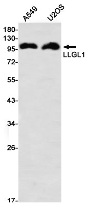 LLGL1 Rabbit Monoclonal Antibody