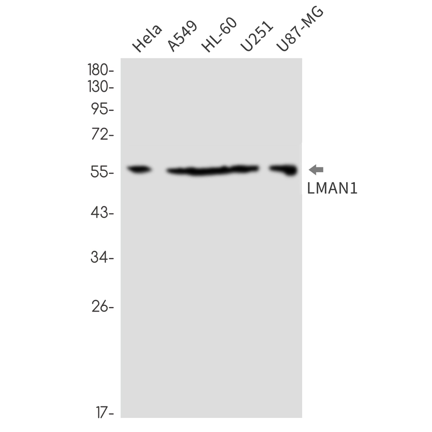 LMAN1 Rabbit Monoclonal Antibody