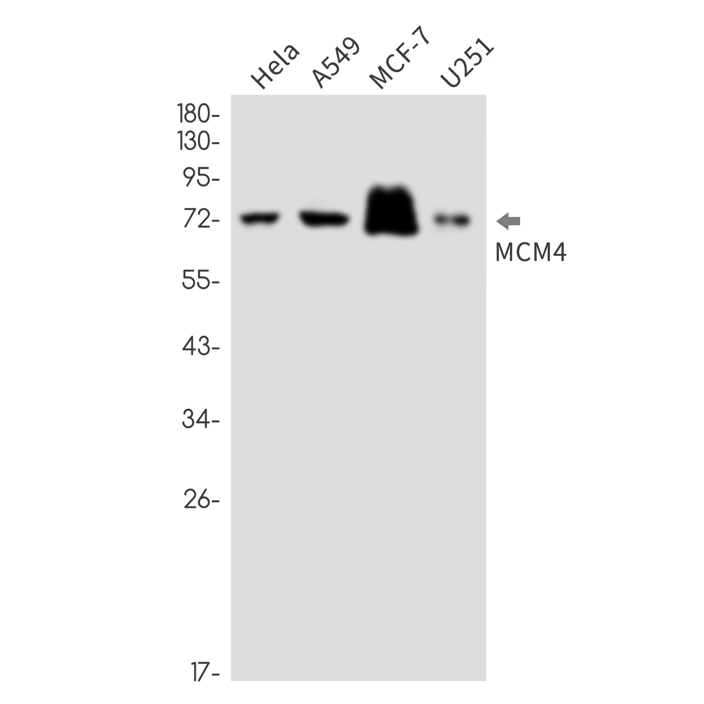 MCM4 Rabbit Monoclonal Antibody