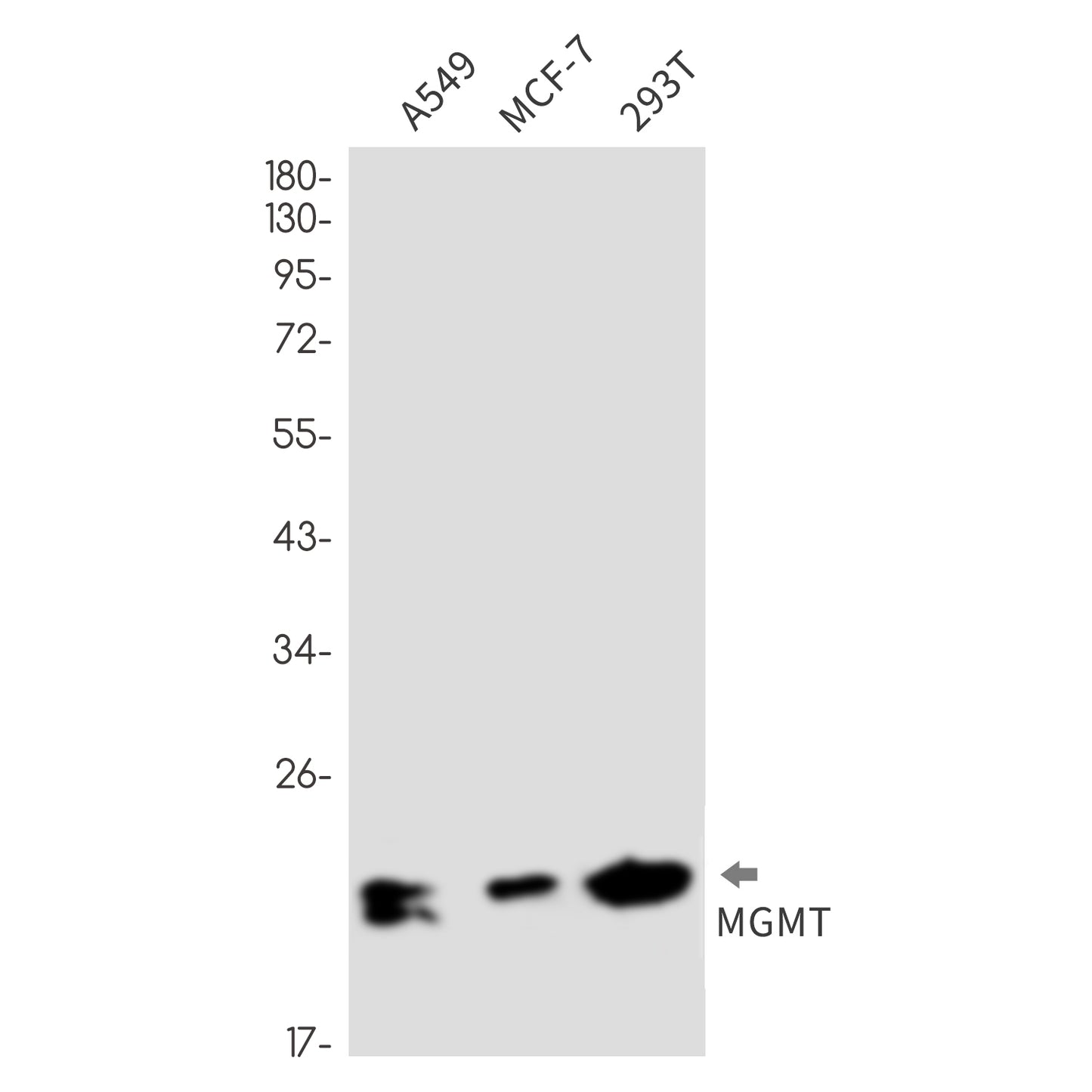 MGMT Rabbit Monoclonal Antibody