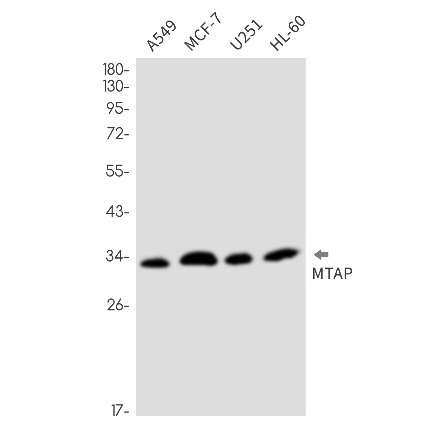 MTAP Rabbit Monoclonal Antibody