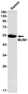 Interferon Regulatory Factor 4 Rabbit Monoclonal Antibody