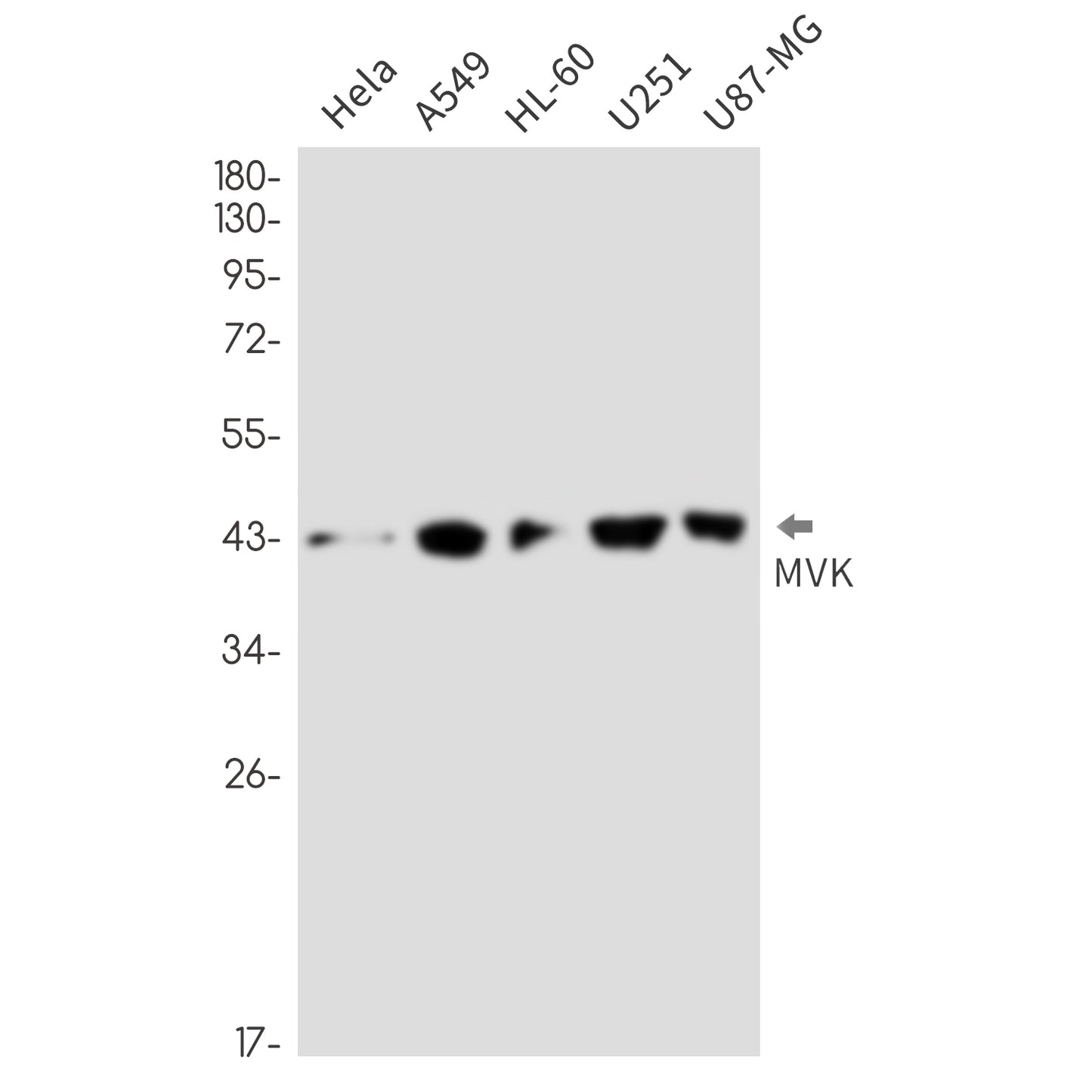 MVK Rabbit Monoclonal Antibody