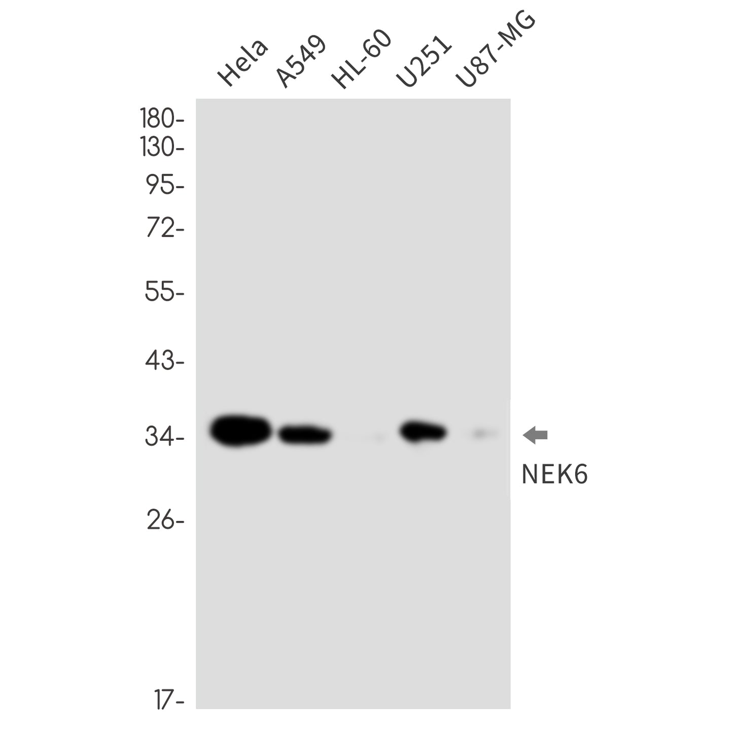 NEK6 Rabbit Monoclonal Antibody