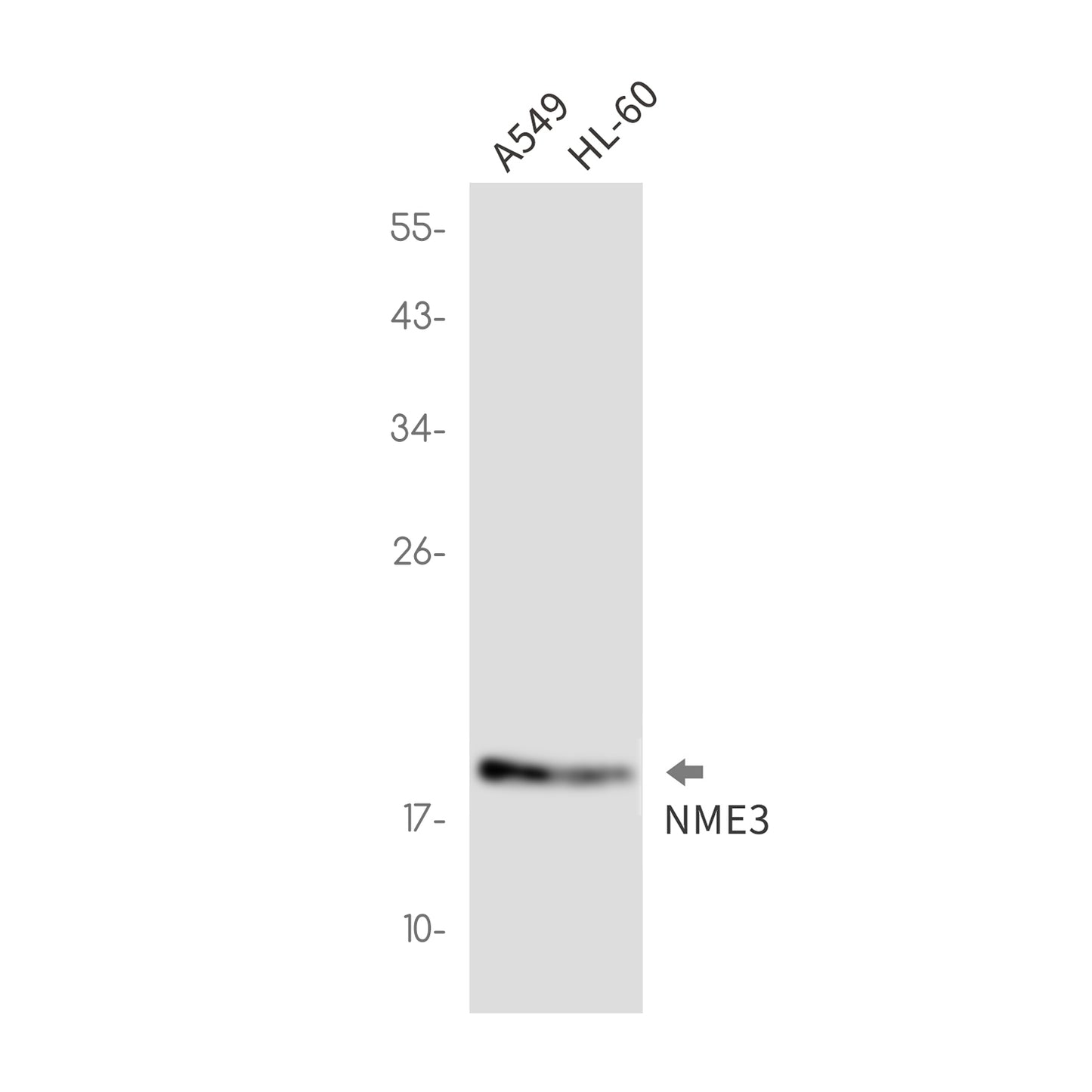 NME3 Rabbit Monoclonal Antibody