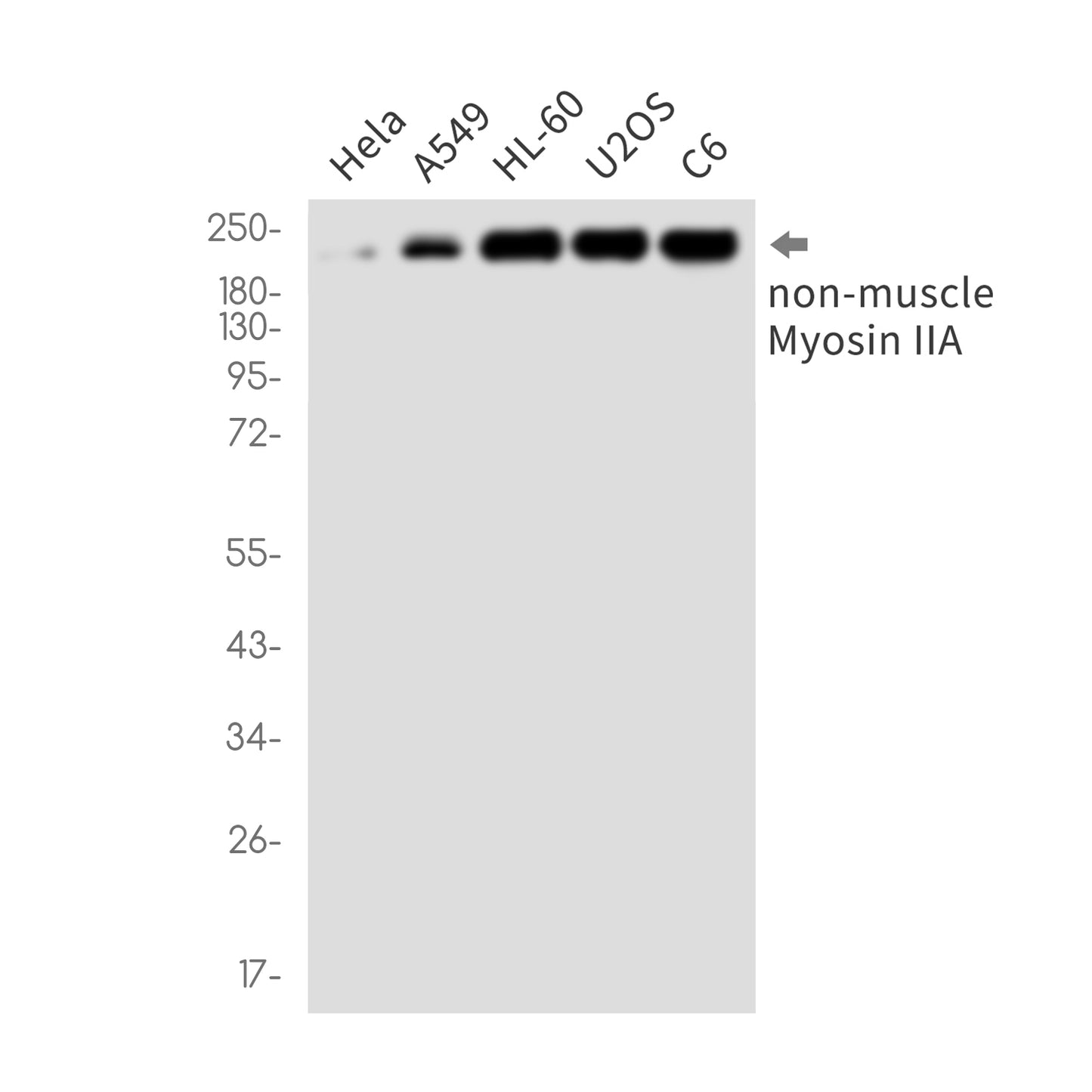 MYH9 Rabbit Monoclonal Antibody