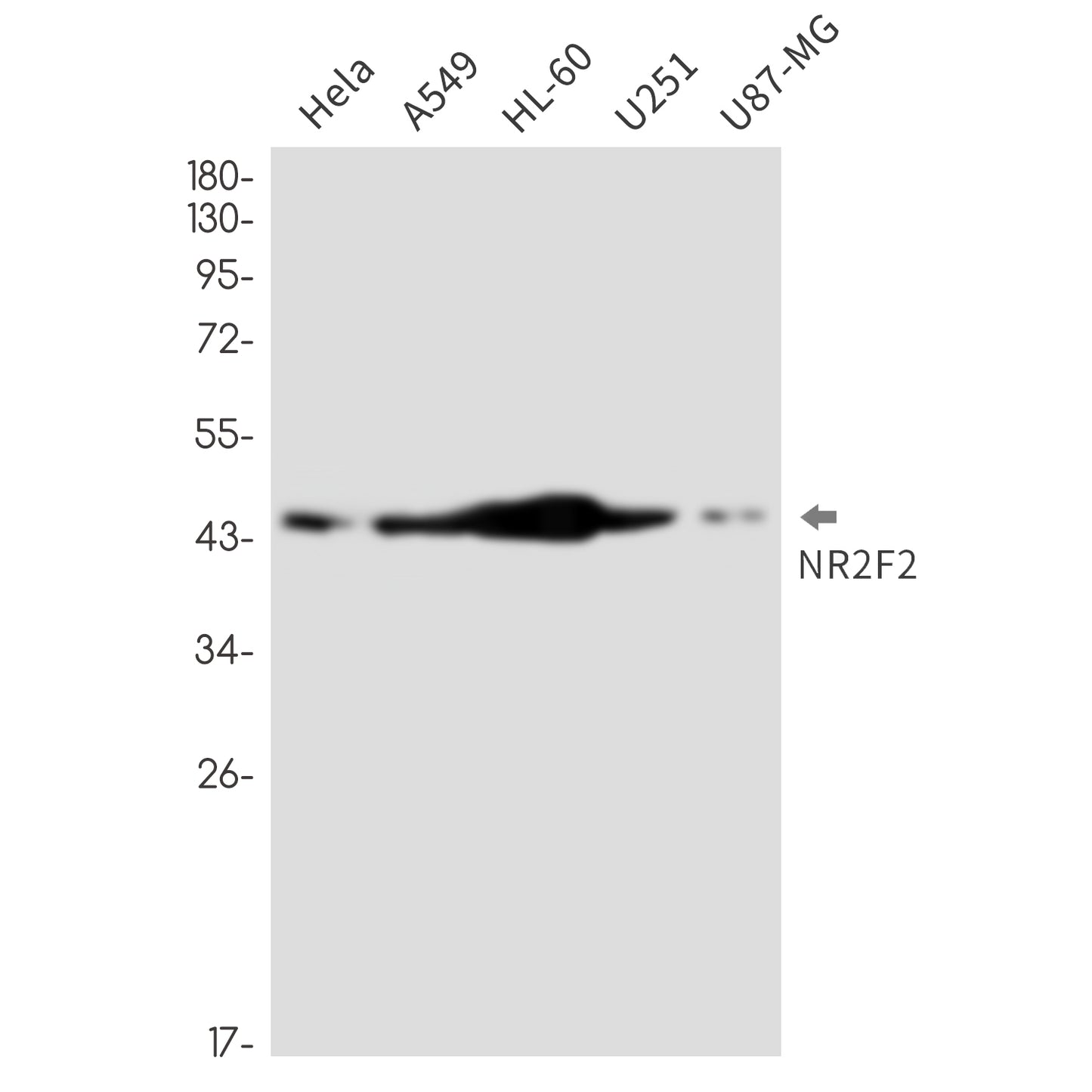 NR2F2 Rabbit Monoclonal Antibody