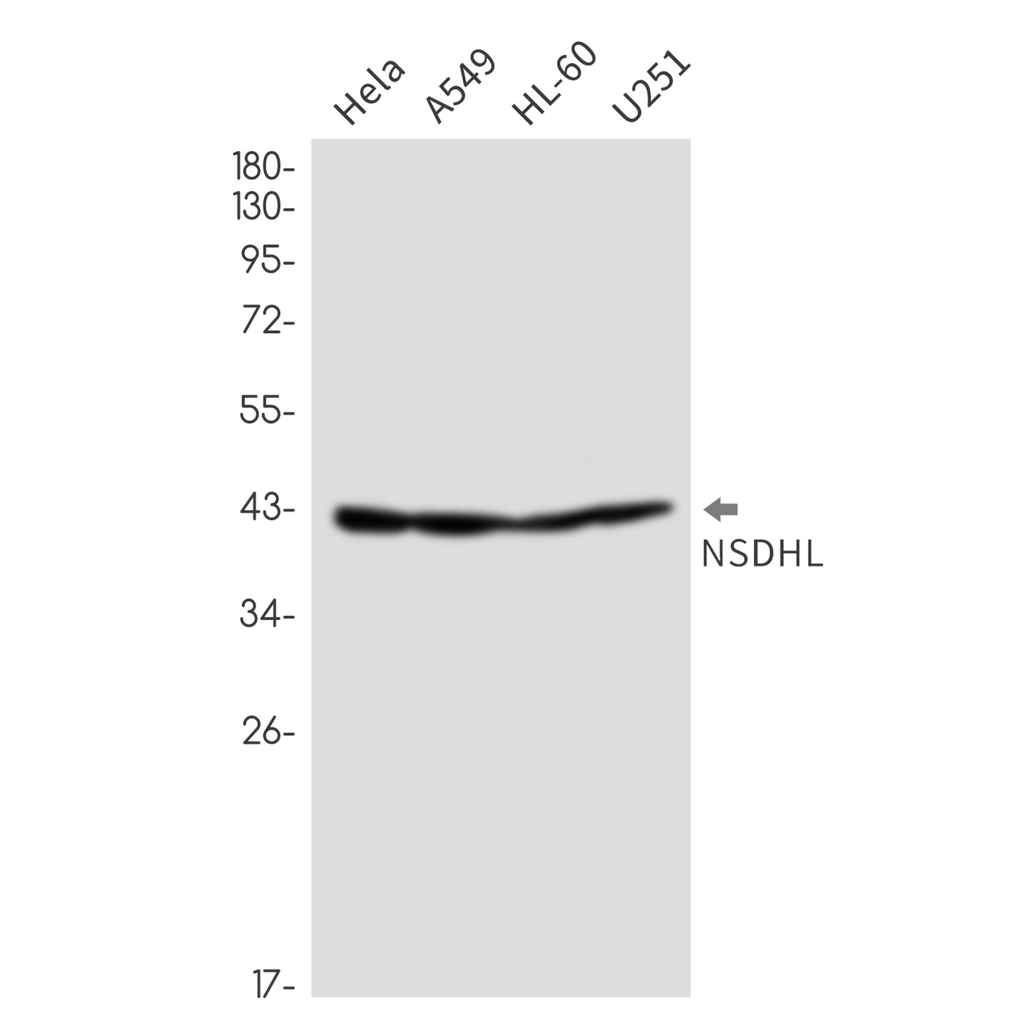 NSDHL Rabbit Monoclonal Antibody