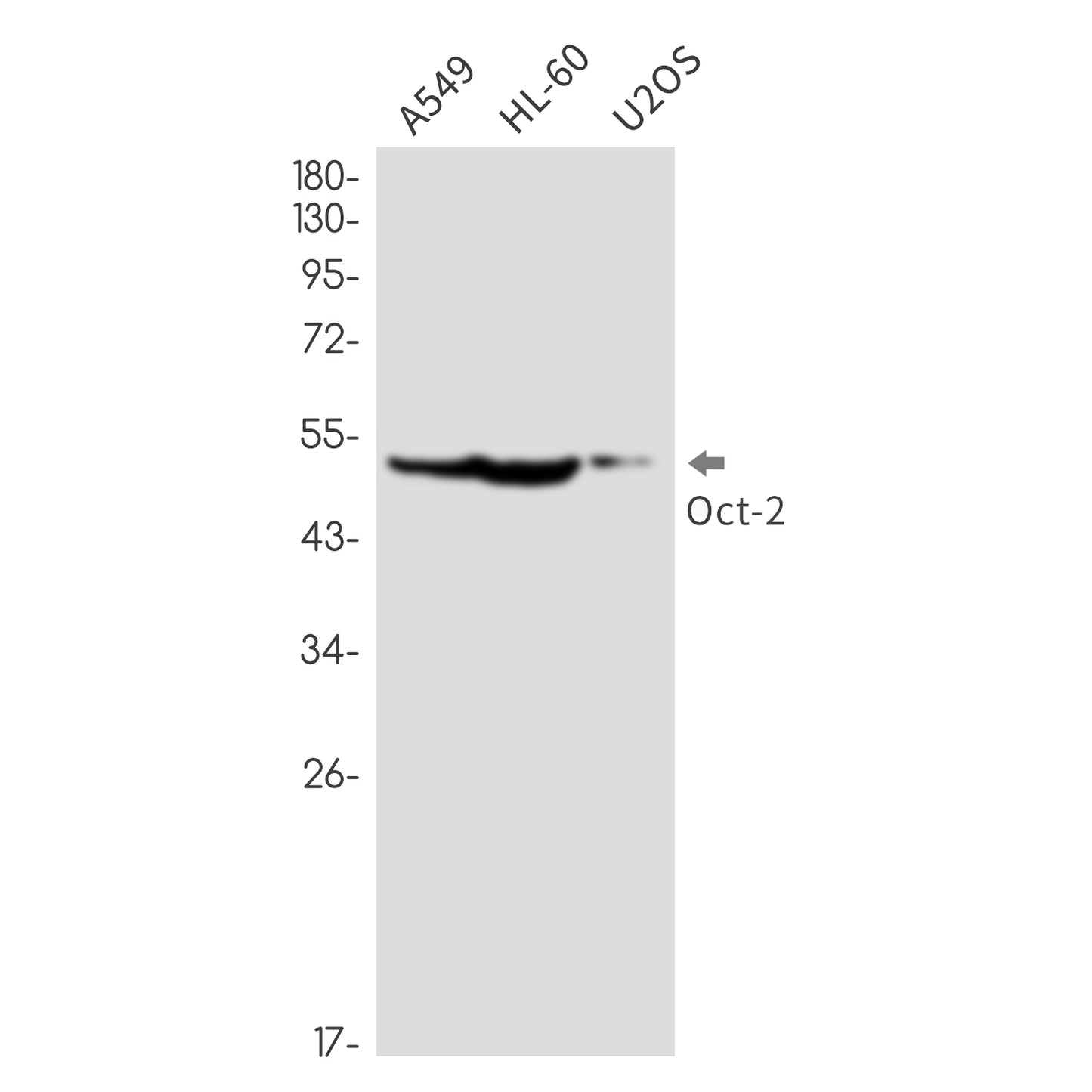 Oct-2 Rabbit Monoclonal Antibody