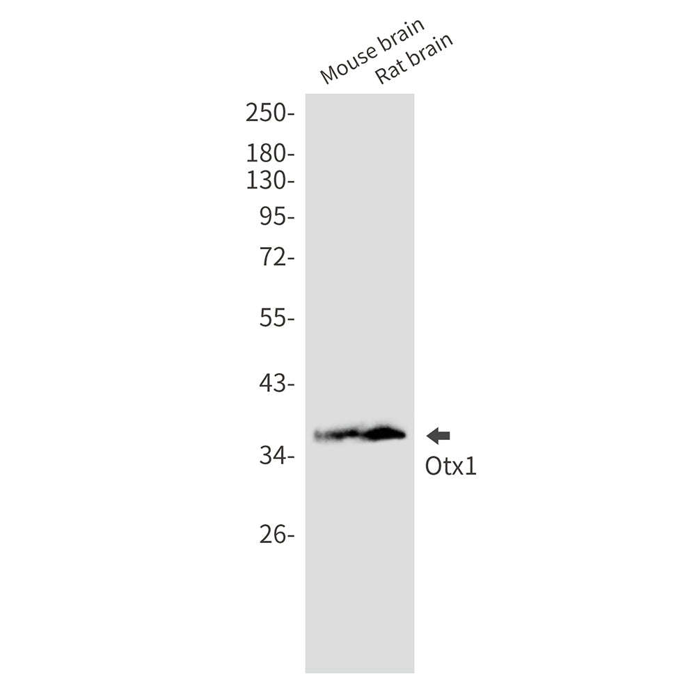 OTX1 Rabbit Monoclonal Antibody