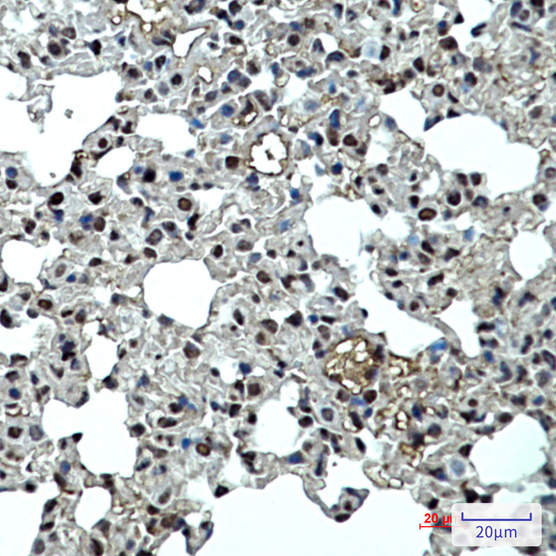 p27 Kip 1 Rabbit Monoclonal Antibody