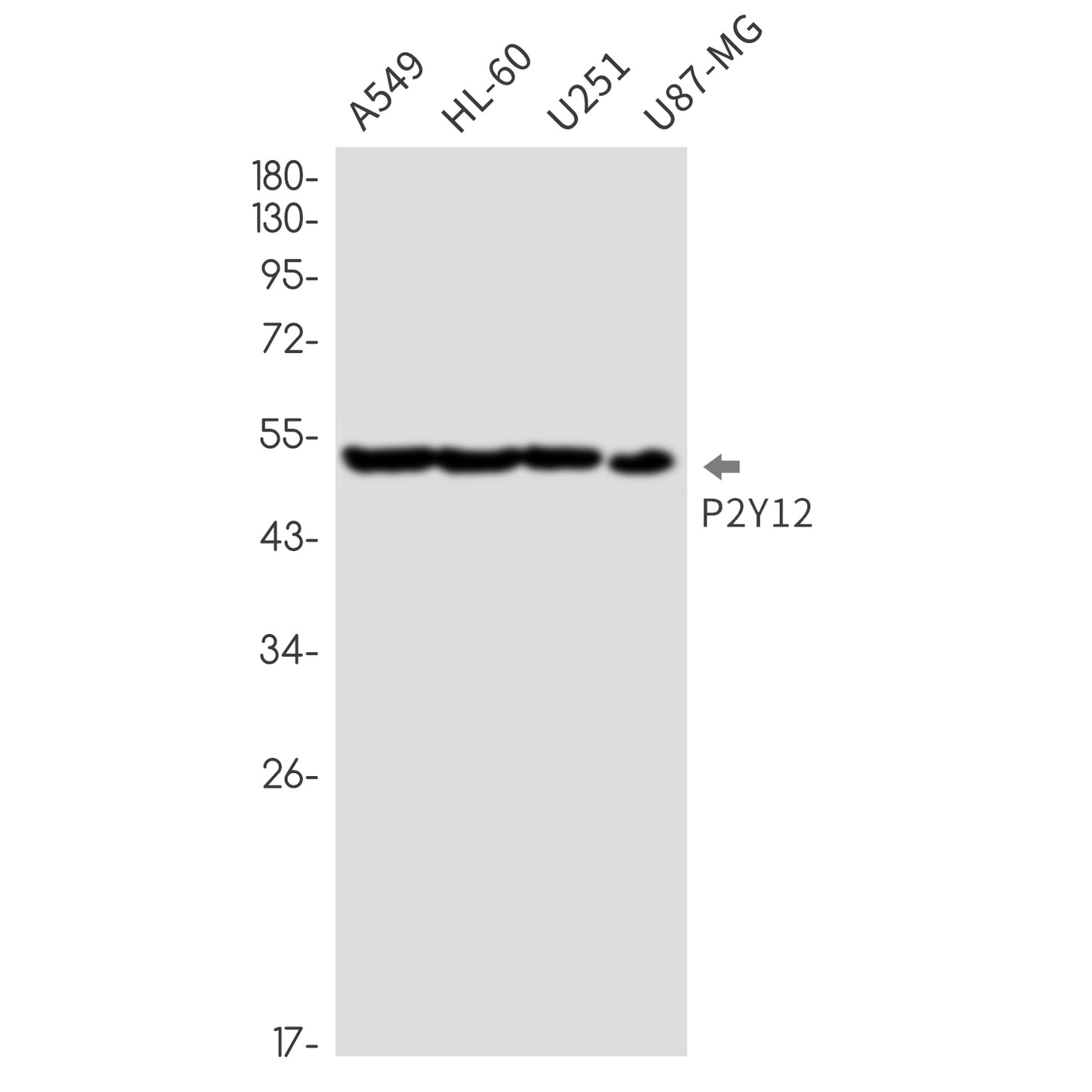 P2Y12 Rabbit Monoclonal Antibody