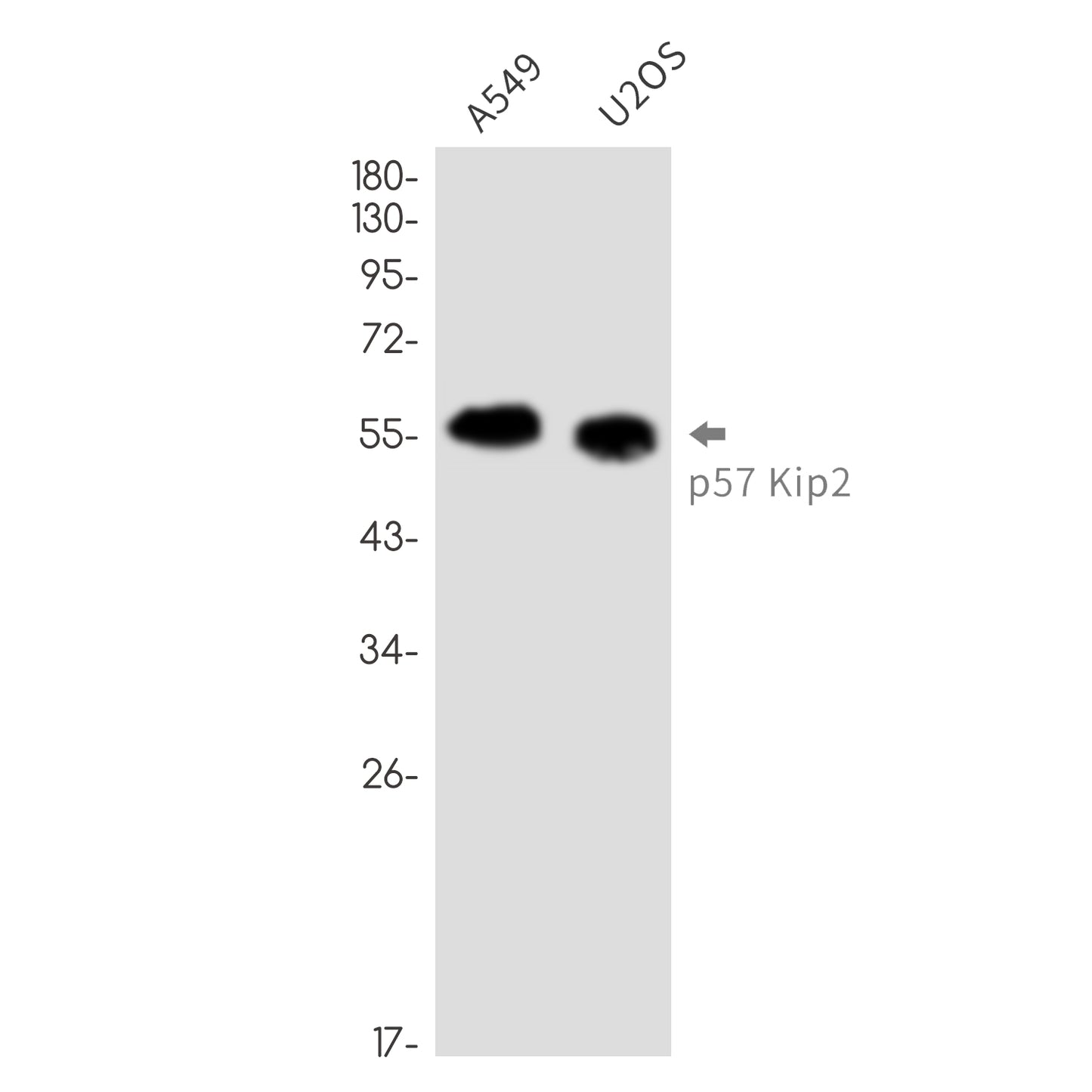 p57 Kip2 Rabbit Monoclonal Antibody
