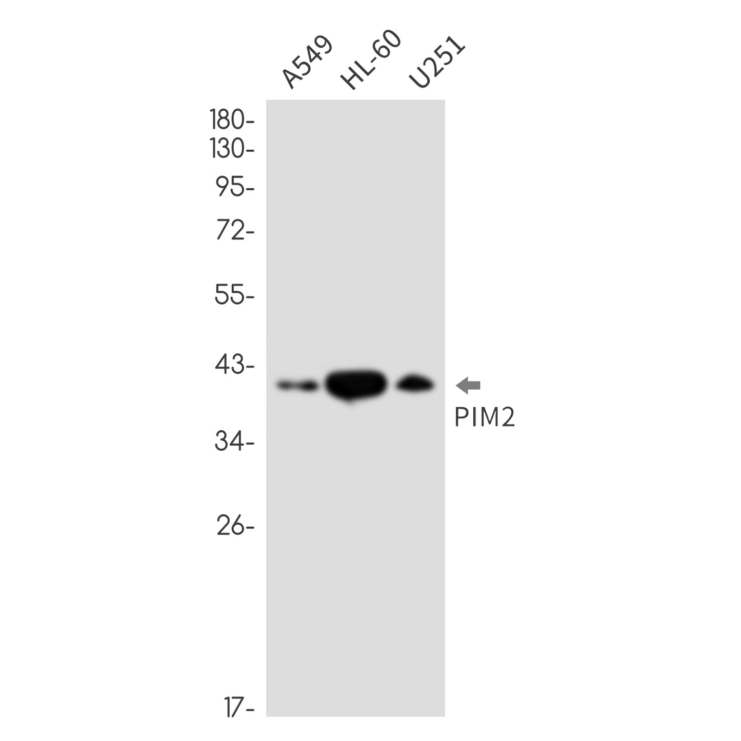 PIM2 Rabbit Monoclonal Antibody