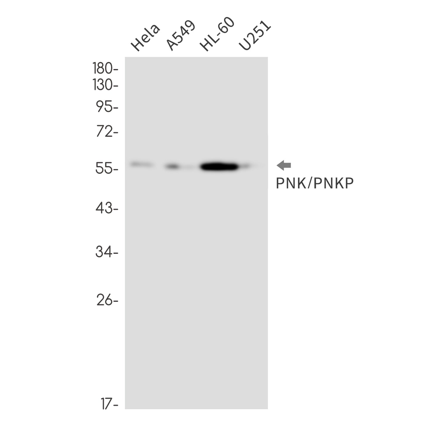 PNKP Rabbit Monoclonal Antibody