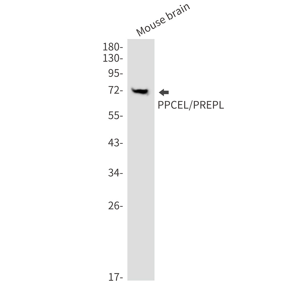 PPCEL Rabbit Monoclonal Antibody
