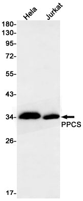 PPCS Rabbit Monoclonal Antibody